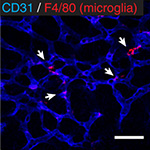 The importance of microglia in the development of the vasculature in the central nervous system