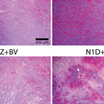 Notch and VEGF pathways play distinct but complementary roles in tumor angiogenesis