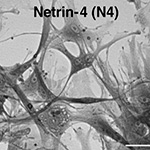 Netrin-4 promotes mural cell adhesion and recruitment to endothelial cells