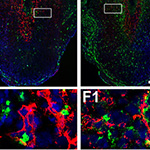 VEGFR-1 blockade disrupts peri-implantation decidual angiogenesis and macrophage recruitment