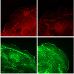 Eicosapentaenoic acid inhibits endothelial cell migration in vitro