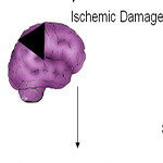 Angiogenesis in old-aged subjects after ischemic stroke: a cautionary note for investigators