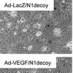 Notch modulates VEGF action in endothelial cells by inducing Matrix Metalloprotease activity