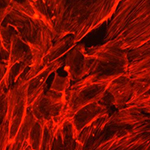 Cyclic strain upregulates VEGF and attenuates proliferation of vascular smooth muscle cells